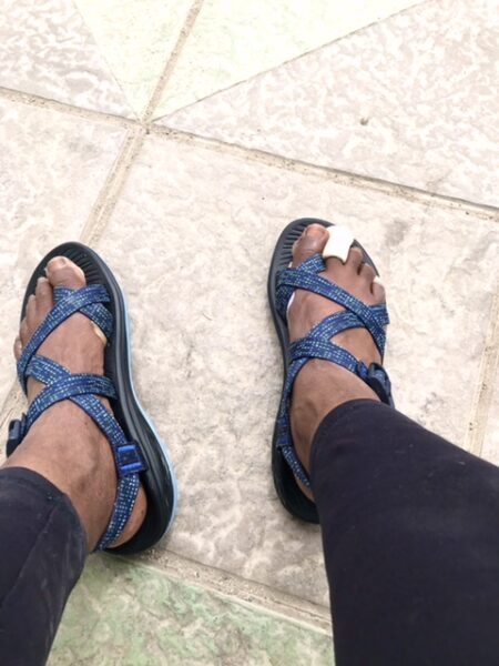 Two feet with bandaged toes in blue sandals.